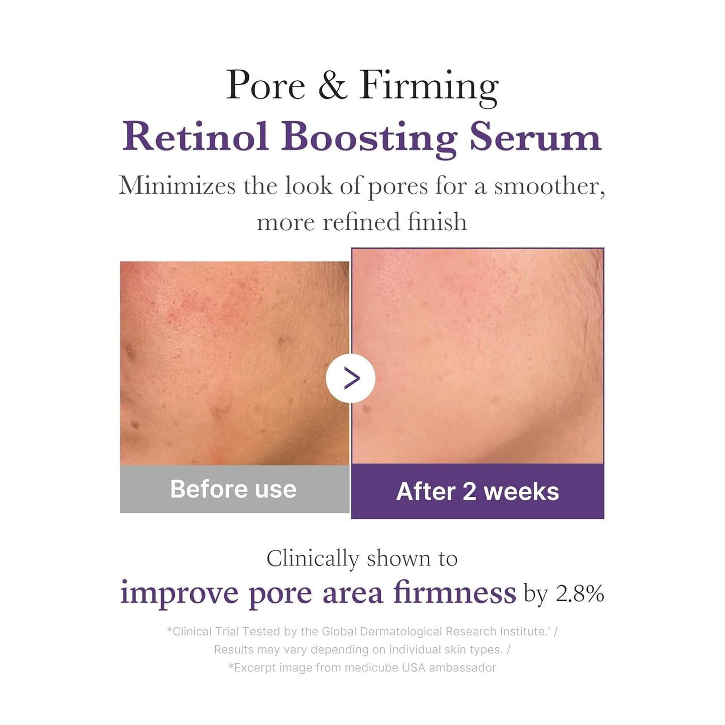 Medicube - Retinol NMN Boosting Serum - 30ml