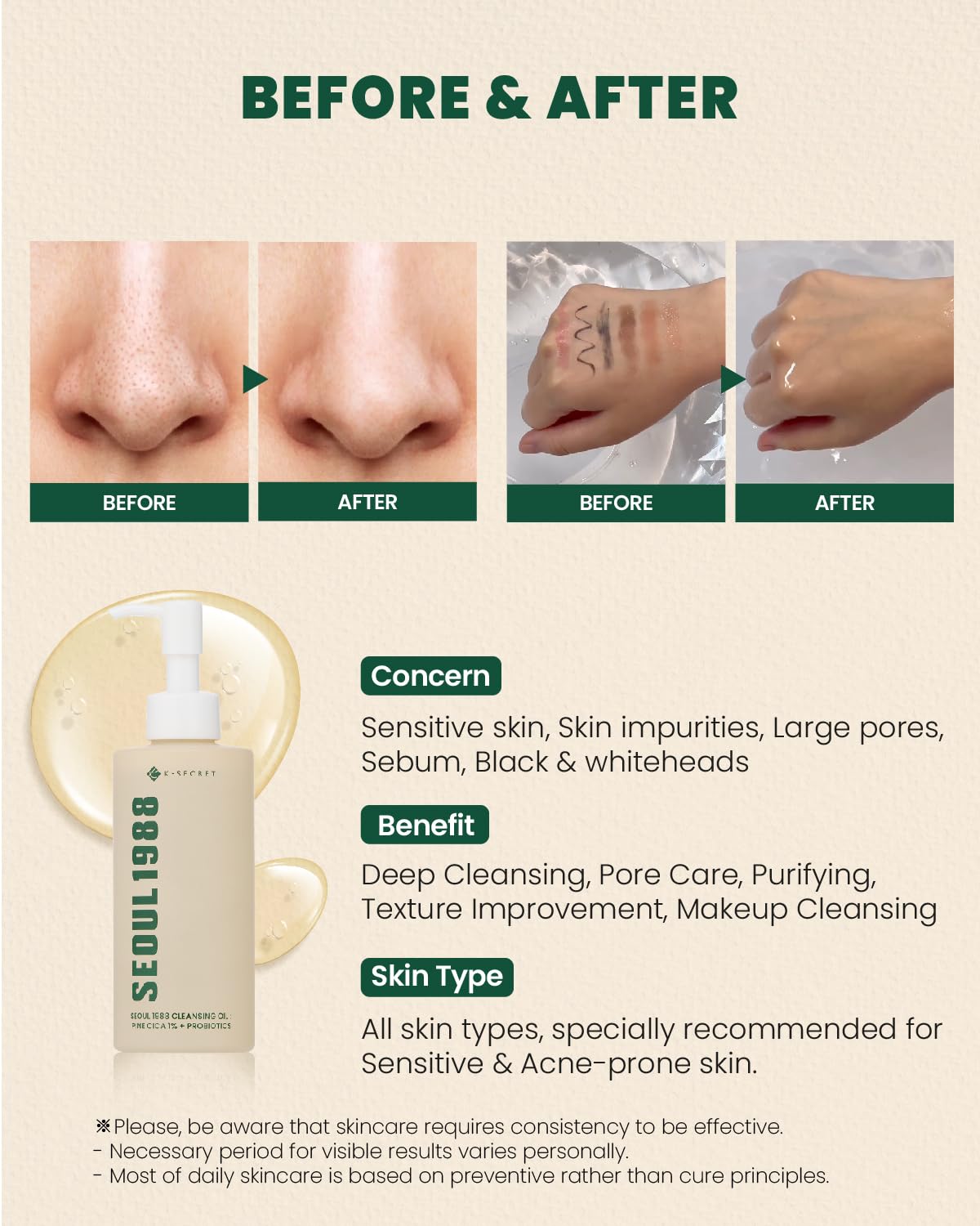 K-SECRET SEOUL 1988 Cica Cleansing Oil – Deep Pore Cleansing & Gentle Exfoliation | Daily Oil Cleanser for Sensitive Skin | Korean Skincare, 200ml / 6.76 fl oz